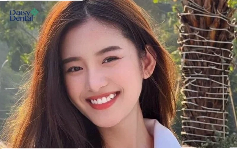 Ảnh cô gái châu Á cười tươi, khoe vẻ đẹp tự nhiên